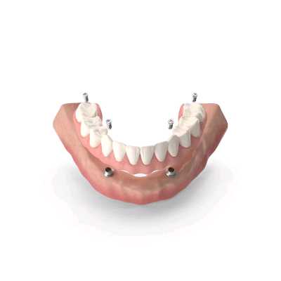 Service Image 1